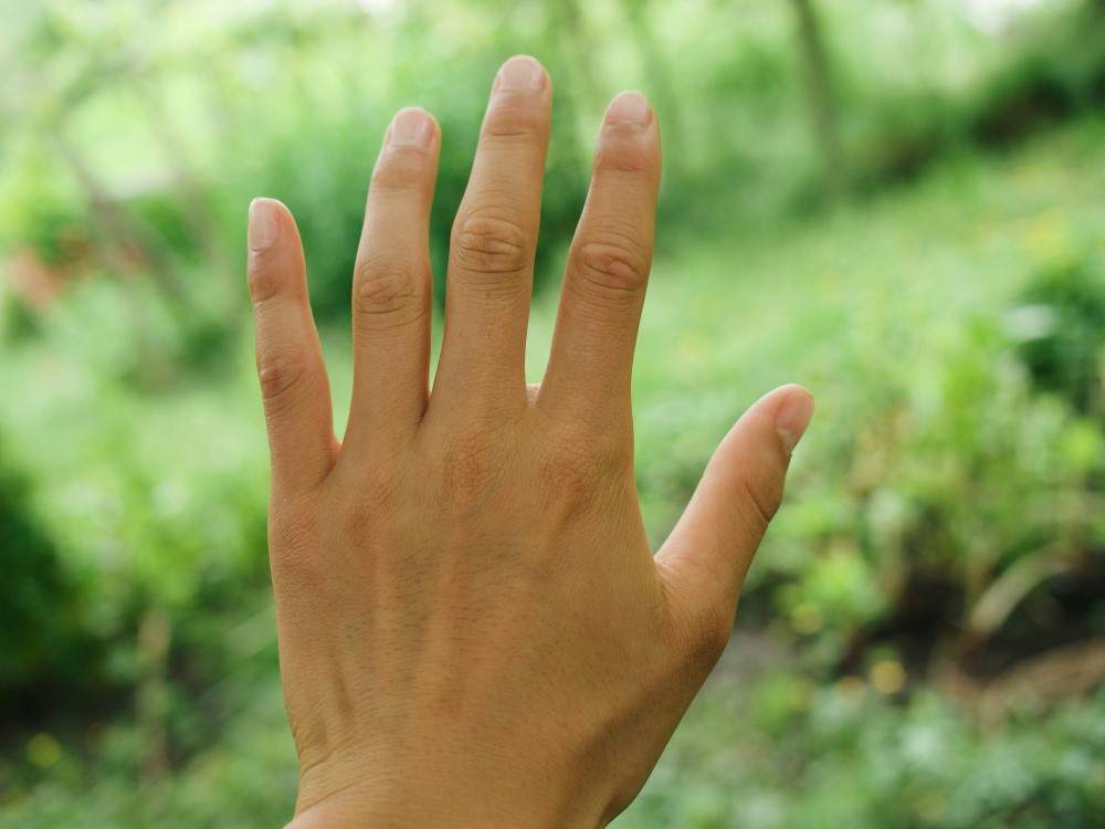 presentation-photo-d-une-main-au-doigt-gonfle-et-du-mal-a-le-plier Présentation d'une photo d'une main au doigt gonflé et du mal à le plier