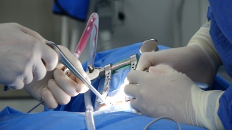 Arthrodèse lombaire : Opération, rééducation, taux de réussite