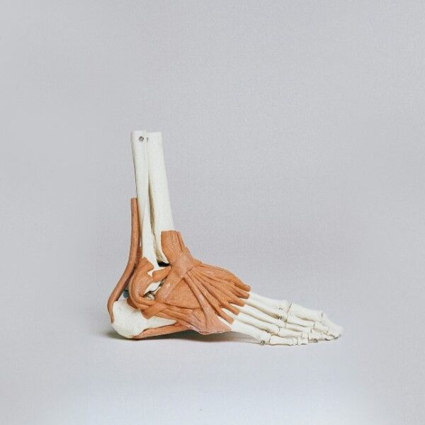 Comment soulager une douleur sur le dessus du pied ?