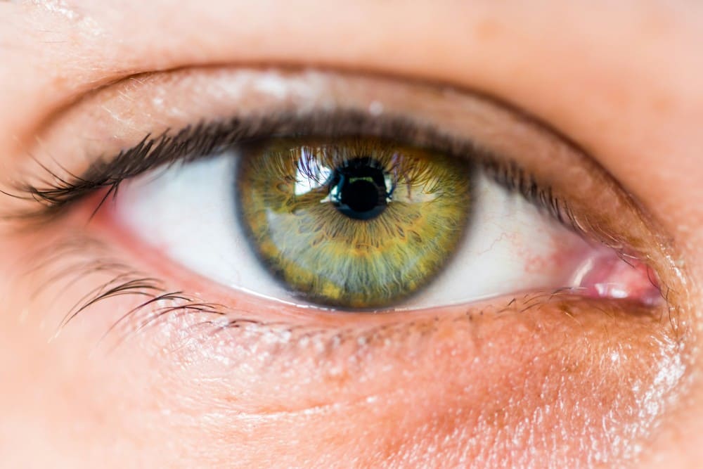 Chirurgie réfractive, œil parfait sans lunettes