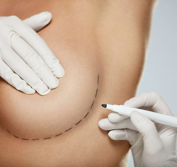 Comment fonctionne l’augmentation mammaire Preservé ?