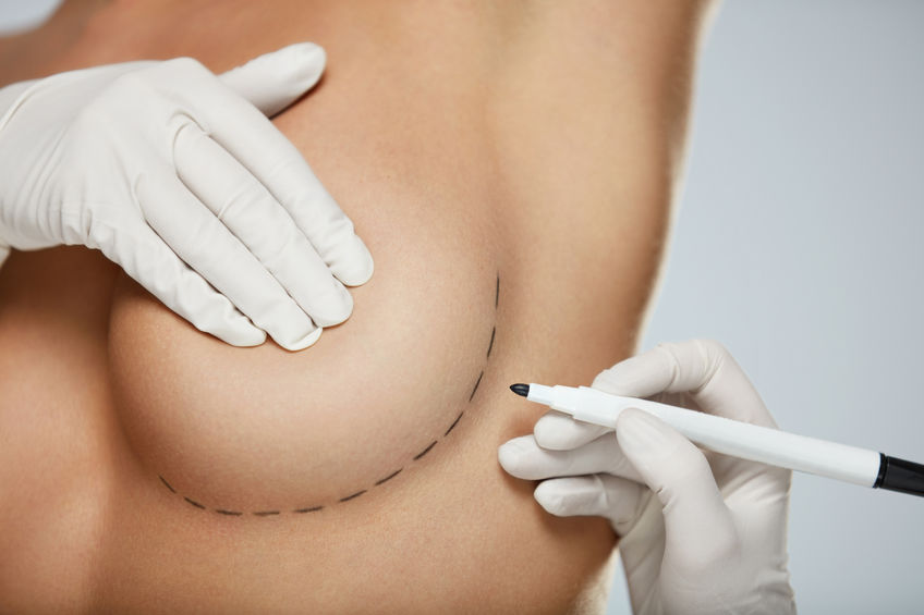 Comment fonctionne l’augmentation mammaire Preservé ?