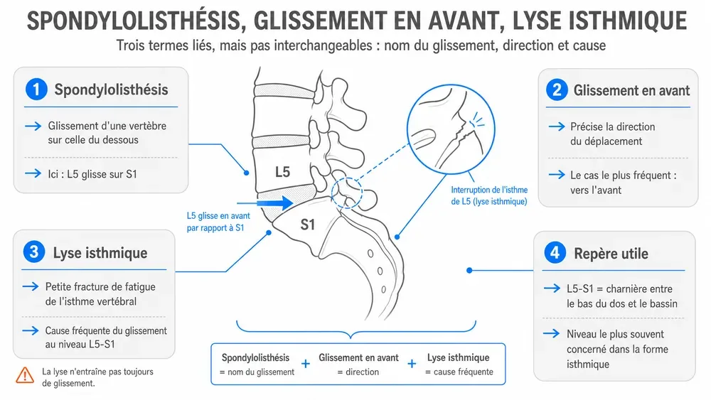 SPONDYLOLISTHÉSIS, GLISSEMENT EN AVANT, LYSE ISTHMIQUE. Trois termes liés, mais pas interchangeables : nom du glissement, direction et cause.