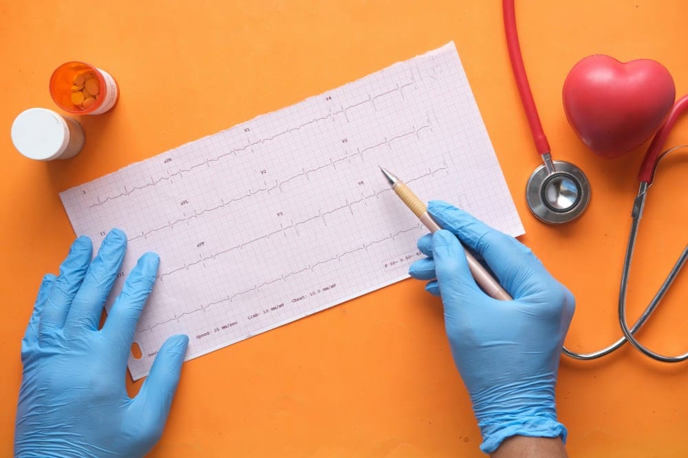 Médecin qui interprète un électrocardiogramme